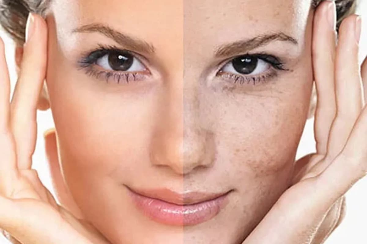 https://s2.webstatic.net/post/skin-pigmentation-treatment/1767547931101fc7-1200x800.webp
